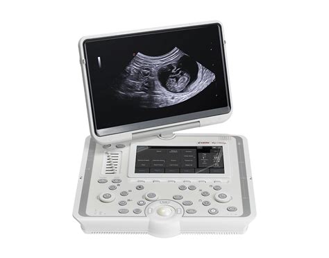 esaote mylab omega price|Portable ultrasound scanners for sale .